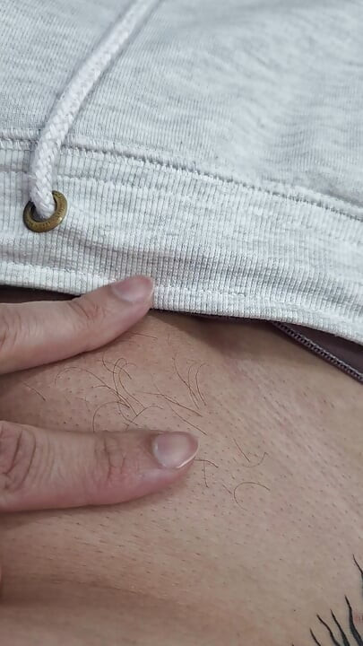 The Hair on My Penis - Led Hair Removal