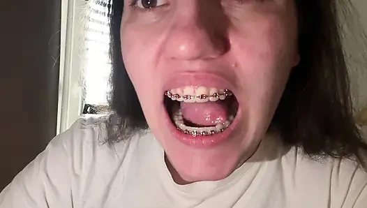 Dilinizle diş teli yalamak