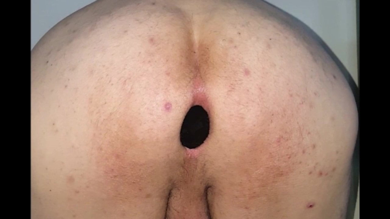 buttplug