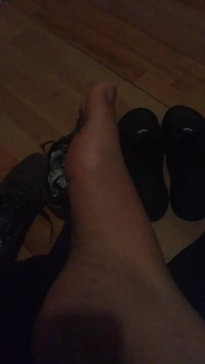 Moje noge za tebe