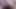 ベイトで生きる-アナル拡張とおなら