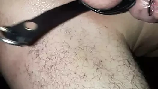 anal