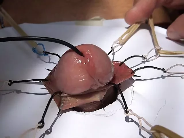 foreskinplay