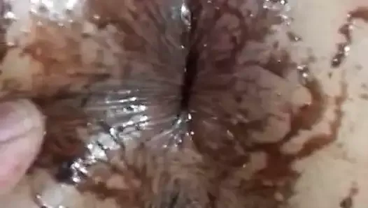 Chocolate anal mas desgarre vaginal