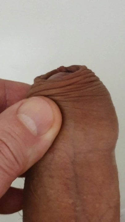 Foreskin
