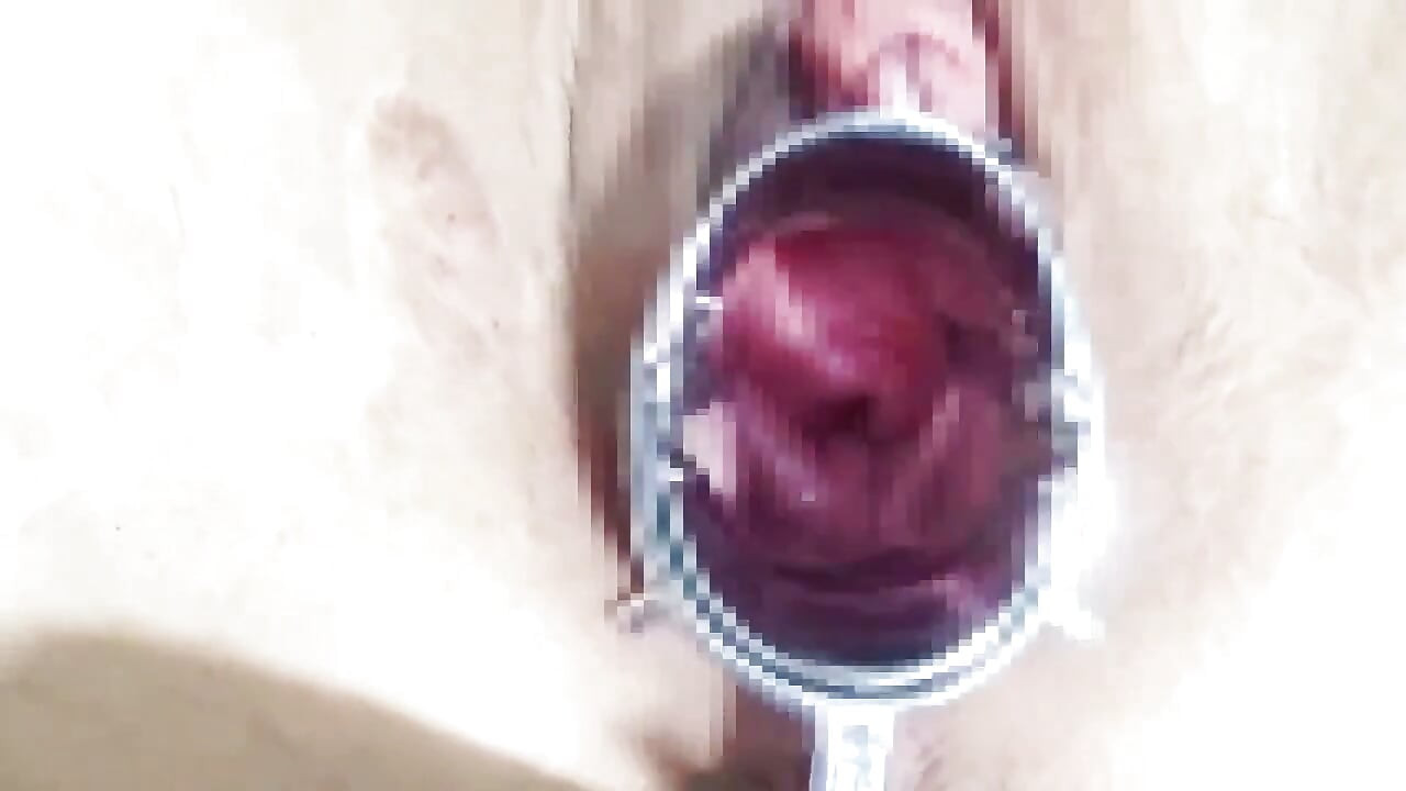 Using a Speculum to Spread an M-woman's Pussy, Anal Training　1/2