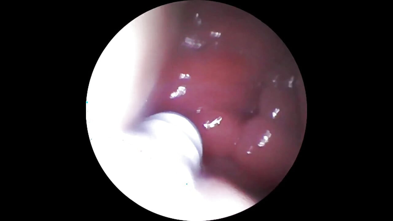 Camera Inside My Wife’s Pussy and Squirt