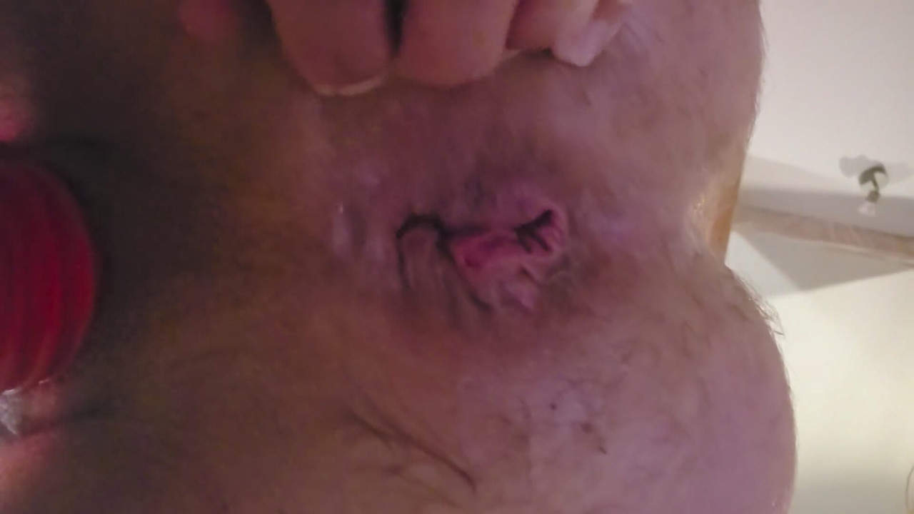 Rear Hole