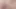 my male boobs - close and far