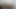 Just Shaving #1 Post-op Orgasm Pussy Clit Masturbation Teasing Orgasm