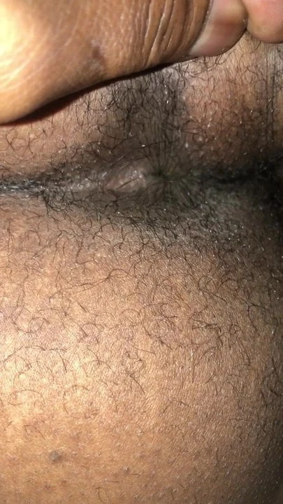 My girlfriend hairy asshole