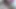 Lizzy Yum October 2023 AMBER ELECTRO SHOCK WAND quickie 3 Post Op Orgasm Pussy Masturbation Teasing