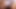 A woman with a big clitoris