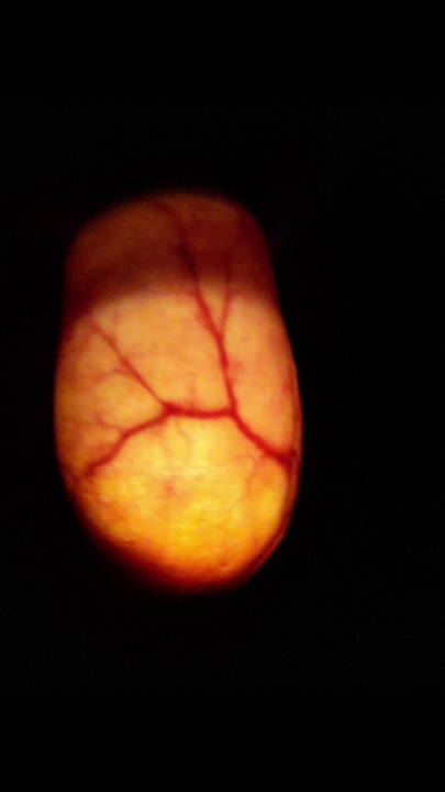 Lighting up my foreskin