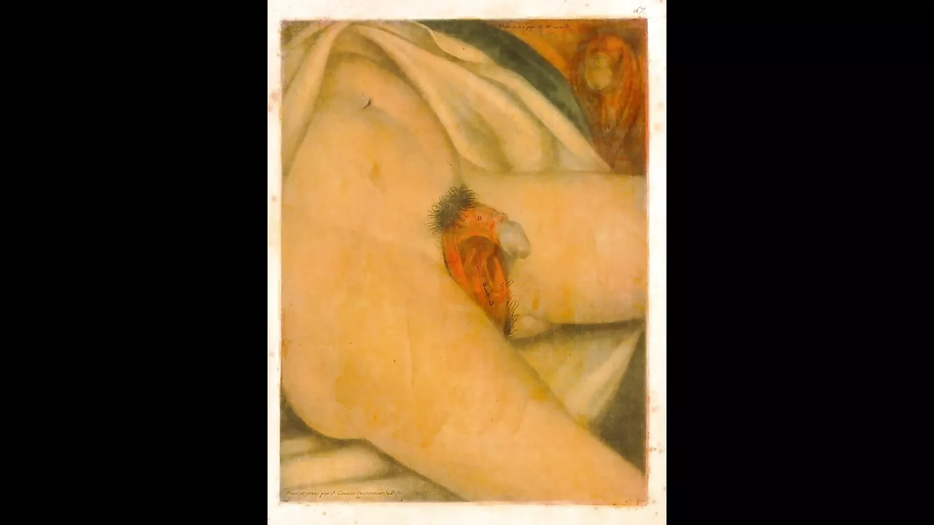 Hermaphrodite
