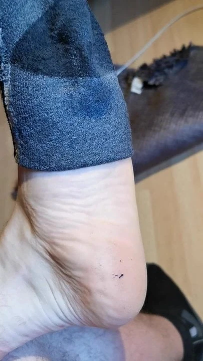 Smelly Feet after work.