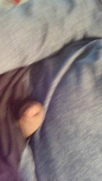 スキンフラワー