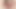SCHLAUCHDILATOR IN (webQ).WMV