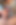 誰が私がそれらを取り除くのを手伝ってくれますか?