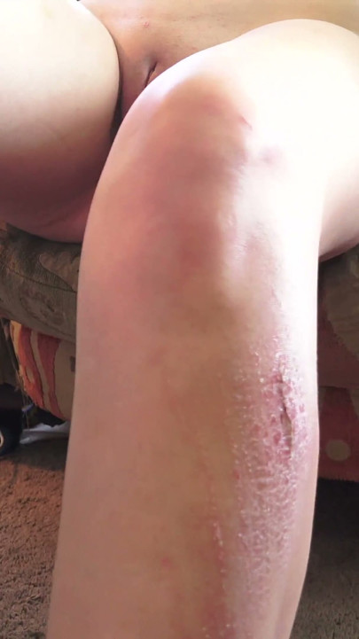 Sunny's Sexy Scars
