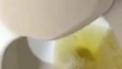 Altın yağmur 17 wsrh