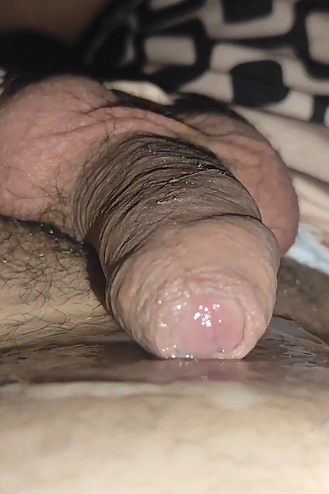 Removal of Phimosis to the White Juice of Hot Cum.