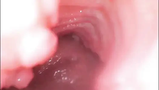 Endoskop dölleme. Amcık içindeki kamera yarağın amının içine boşalğını gösteriyor