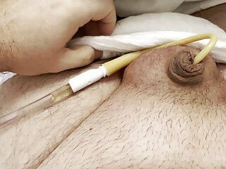Mesane kateteri ve şişmiş topları olan küçük penisli anal: çok boşalıyor!