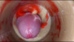 Pratinjau video
