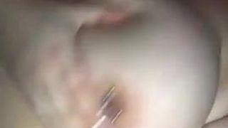 अधिक मोटे स्तन