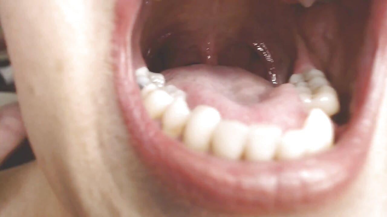 Garganta e boca cuspindo cordas Uvula Tonsils Uvula