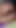Memorable moment from "HUSBAND PUSHES HUGE BLACK COCK INTO MY ASS, IT HURTS, DON'T PUT IT ANYMORE"