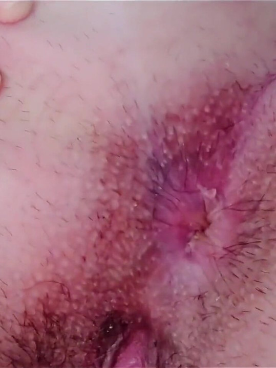 My Hairy Asshole Wants You to Lick It and Enjoys Getting Really Close to Your Face