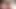 Long foreskin movement (slowmotion) 457
