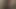 Dev yapay penis bölüm 1