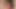 anal