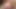 Incredible Tits Hairy Pits - Custom #3