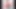 Mega Breast Expansion-Part 13