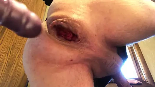 Anal şaşkın fisting büyük yapay penis göt sokma popo fiş