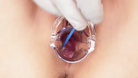 Rahim/serviks, lihatlah keadaanku di dalam! Close-up ekstrem