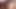 Hardx sulu eşek sarışının bbc anal enjeksiyonu