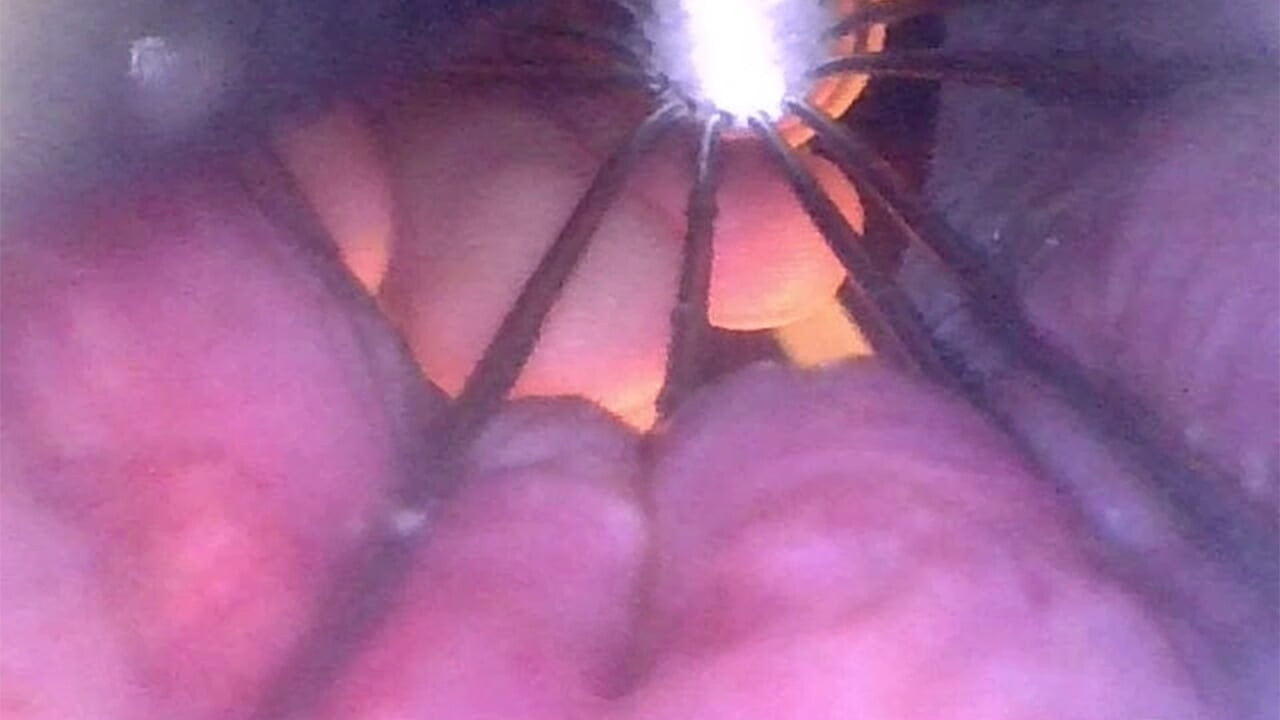 I love looking INSIDE my ass