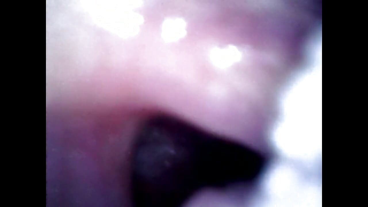 Endoscope Details - Hole Balls Cock Foreskin Belly Nipples Mouth Sperm