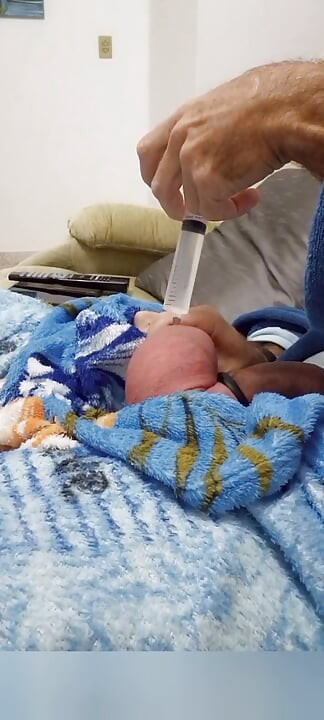 60cc Saline Injection in Each Egg