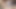 Deep Anal Masturbation Big Gaping Hot Anal Prolapse