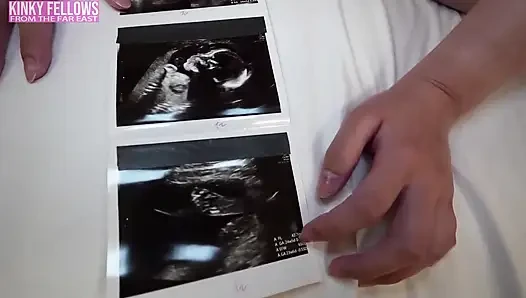 Can Desire Still Burn at 26 Weeks Pregnant? a J Cup Gravure Idol Dares a Risky Mini Uniform Fantasy