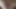 A deep insight into my throat - MyDirtyHobby Nimm-Mich- Geil