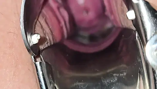 Milf inspects her pussy and inserts speculum to see inside