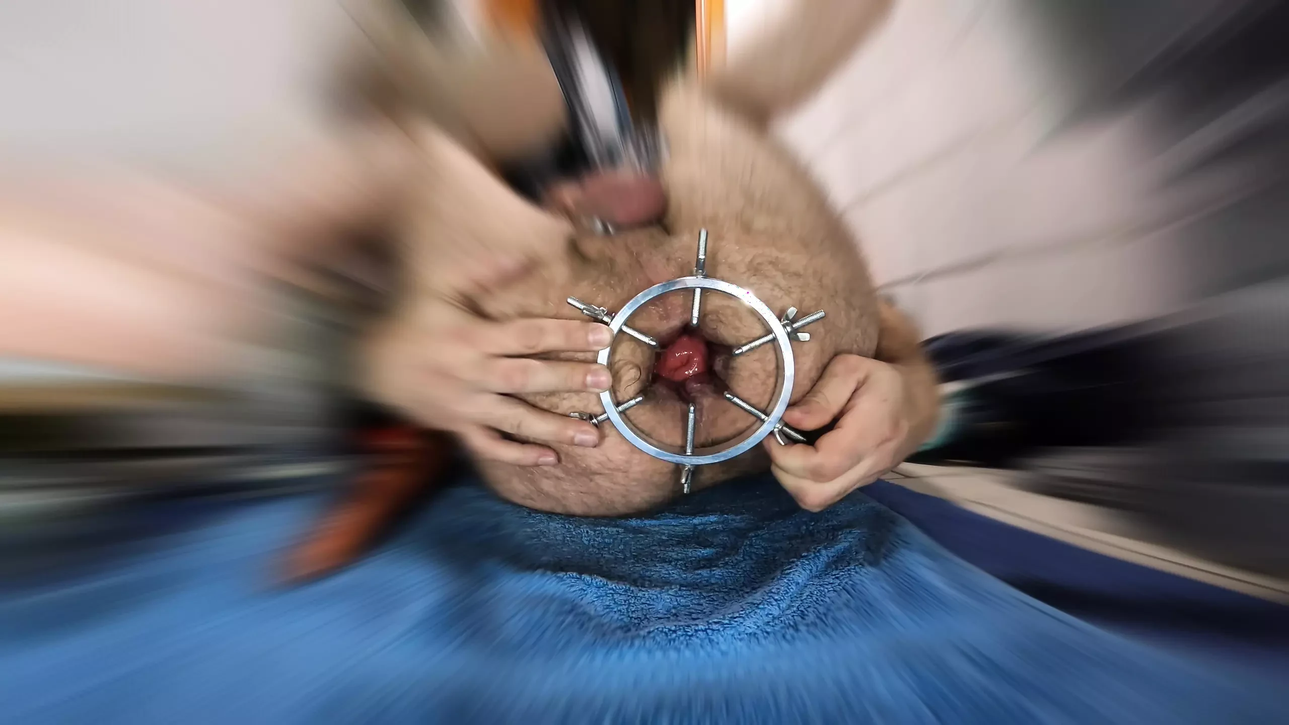 検鏡+アナル
