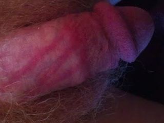 Red marks on my cock
